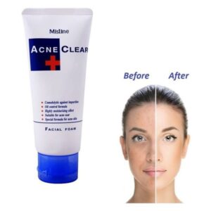 Mistine Acne Clear Face Wash Facial Foam 85 ml - Image 6