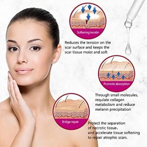 AICHUN BEAUTY Scar Removal Facial Serum Pimples Stretch Marks Face Moisturizing Body Remove Scars Kojic Acid | Vitamin - E | 30ml - Image 8