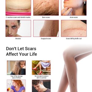 AICHUN BEAUTY Scar Removal Facial Serum Pimples Stretch Marks Face Moisturizing Body Remove Scars Kojic Acid | Vitamin - E | 30ml - Image 3