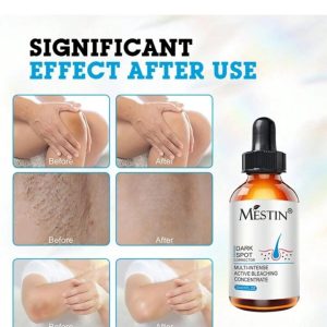 MESTIN Anti-Sun Spot Essence 30ml - Corrects Hyperpigmentation, Fades Dark Spots, Evens Skin Tone, 100% Natural Ingredients, Delays Aging - Image 5