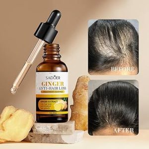 Sadoer Ginger Anti-Hair Loss Treatment Essence 30ml - Restores Hair, Promotes Growth - Image 5