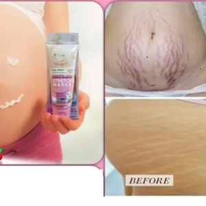 Fruit Of The Wokali Maternity Stretch Marks Cream 130ML For All Skin Type | Best Cream - Image 6